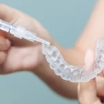 Invisalign Szczecin